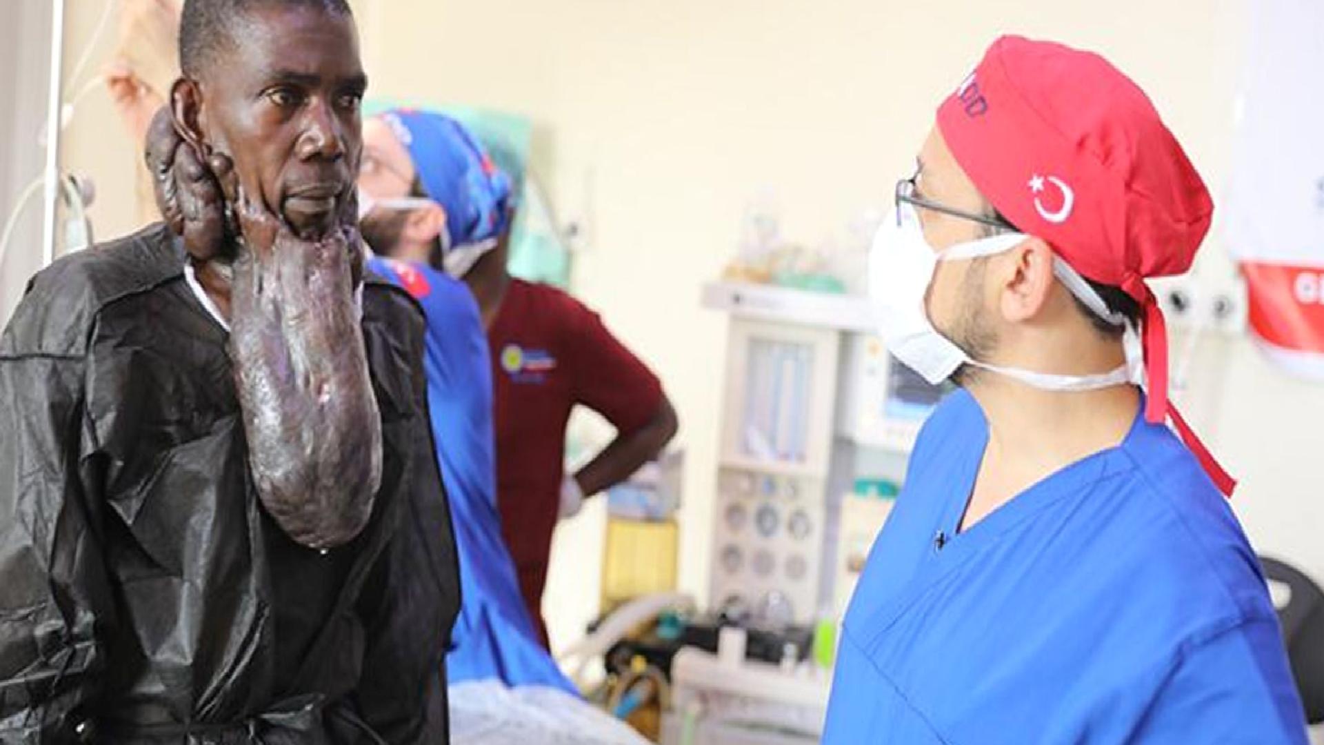 Ugandalı Muhammed’i, yüzündeki 5 kiloluk kitleden Türk doktorlar kurtardı