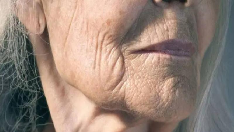 Hücre Atlası: Cildin yaşlanmasını geciktirebilecek yeni bir yöntem keşfedildi