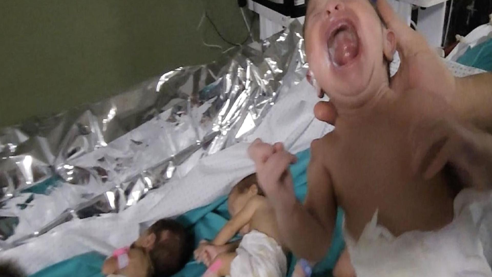 Kuzey Kıbrıs’ta yenidoğan bebeklere su yerine saf alkol verildi: 1 bebek hayatını kaybetti