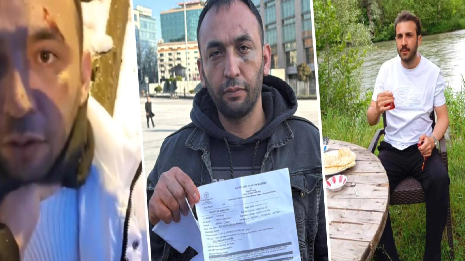 Kağıthane’de eski sevgilisinin evinde tuzağa düşüp darbedilen adam dehşeti yaşamıştı; görüntülerin ardındaki gerçekler ortaya çıktı