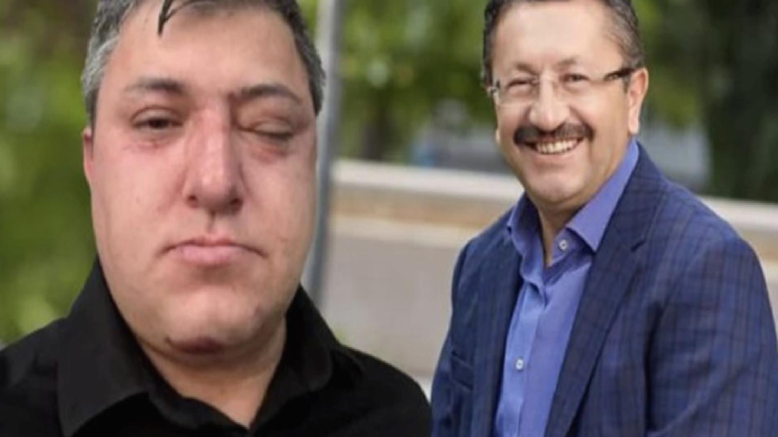 Altındağ Belediyesi’nde ‘dayak timi’: Yedi yıl arayla gerçekleşen iki saldırıda aynı çalışanların olduğu tespit edildi!