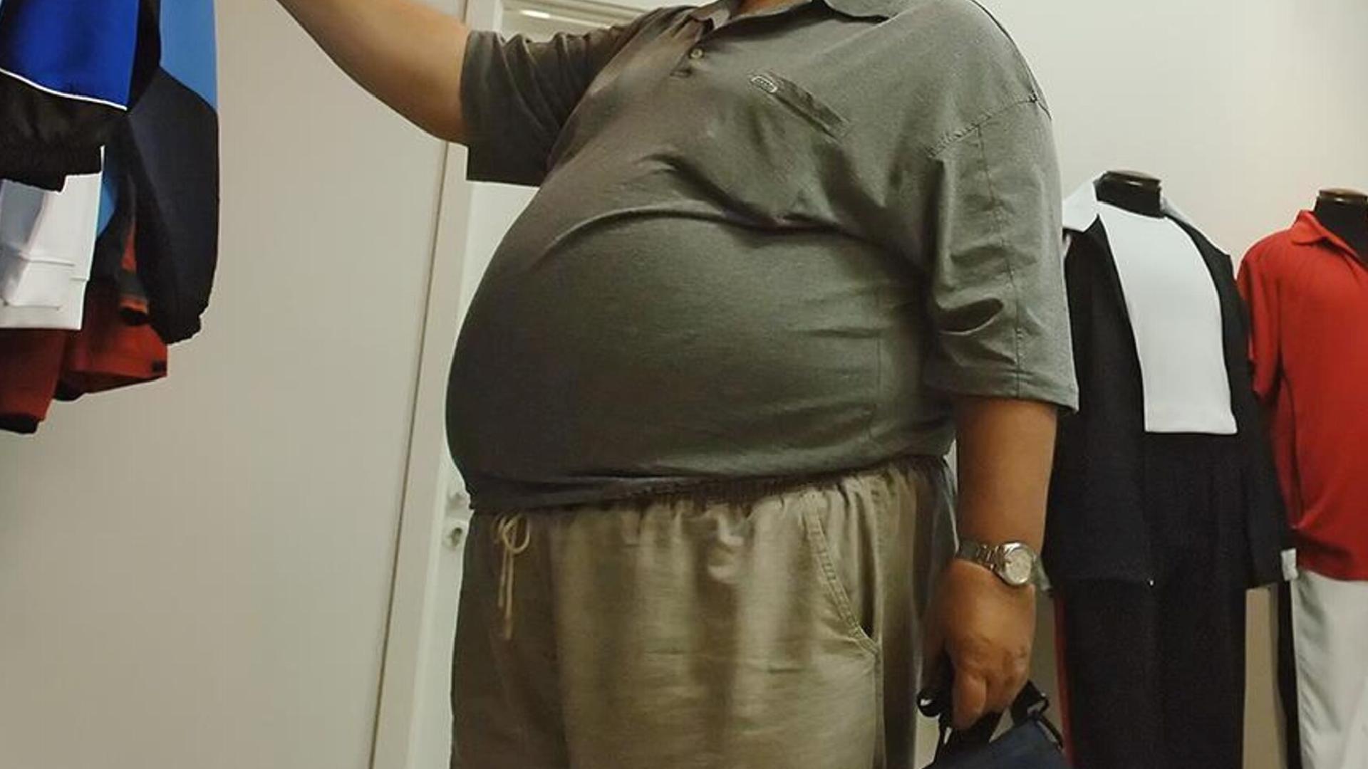 10 milyon kişinin boy ve kilosu ölçüldü: Yüzde 70 fazla kilolu, yüzde 70’in yüzde 25’i de obez