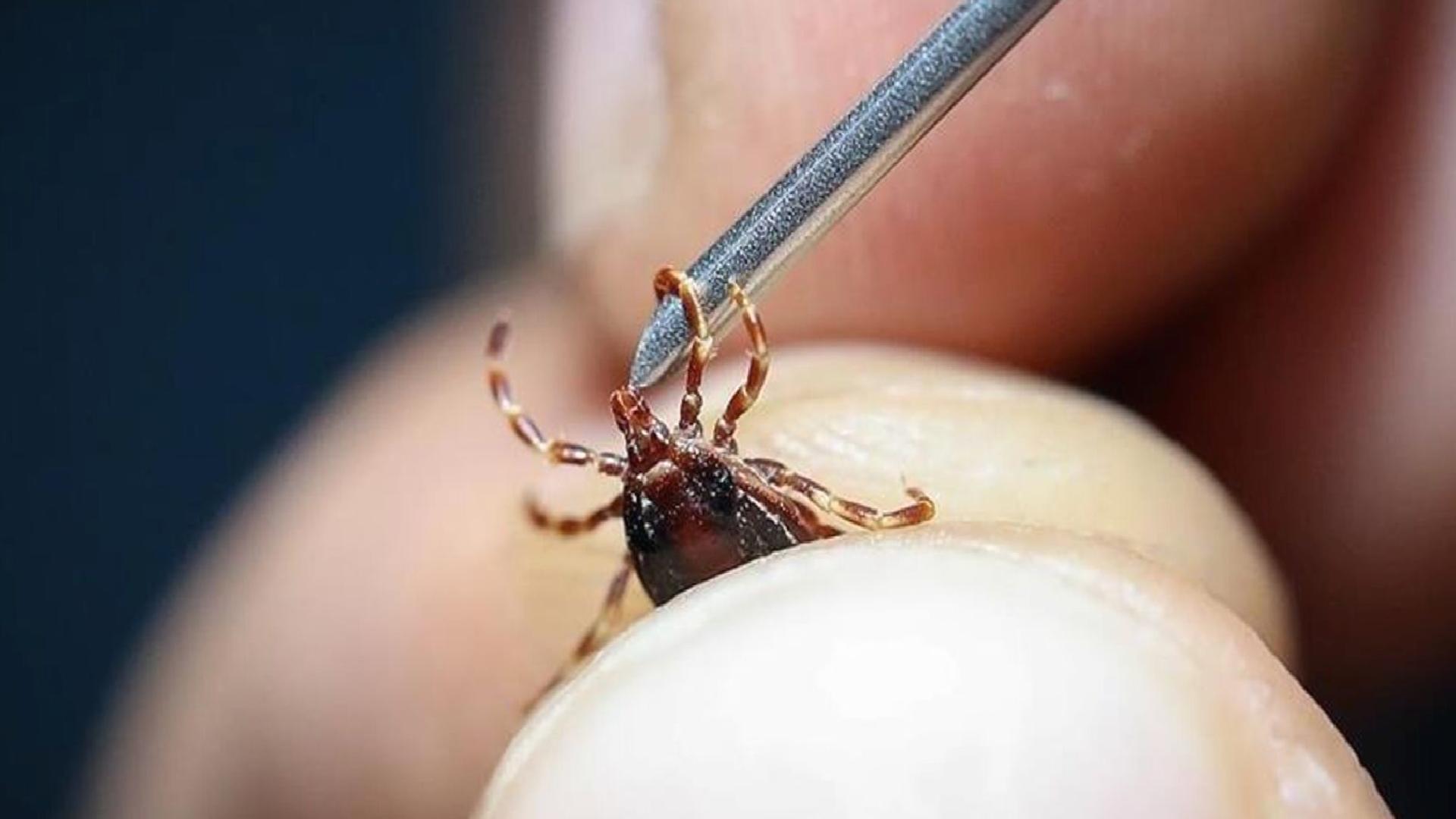 Sivas’ta KKKA şüphesiyle tedavi gören bir kişi hayatını kaybetti