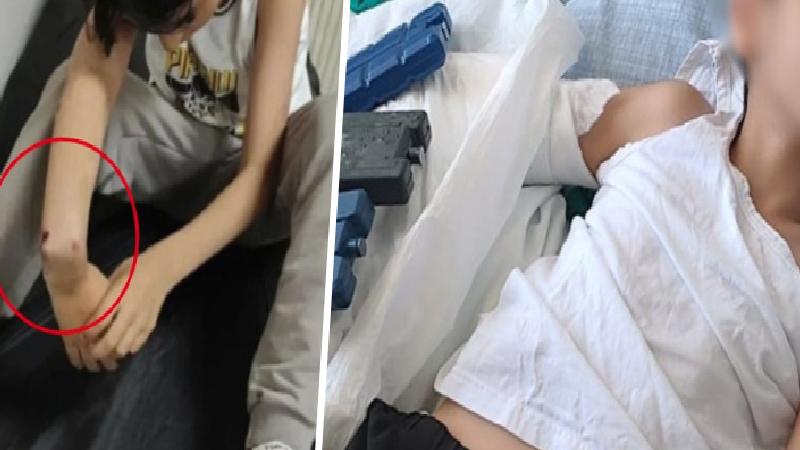 9 yaşındaki çocuğun kolunu kırdığı iddia edilen uzman çavuş, çocuktan şikayetçi oldu!