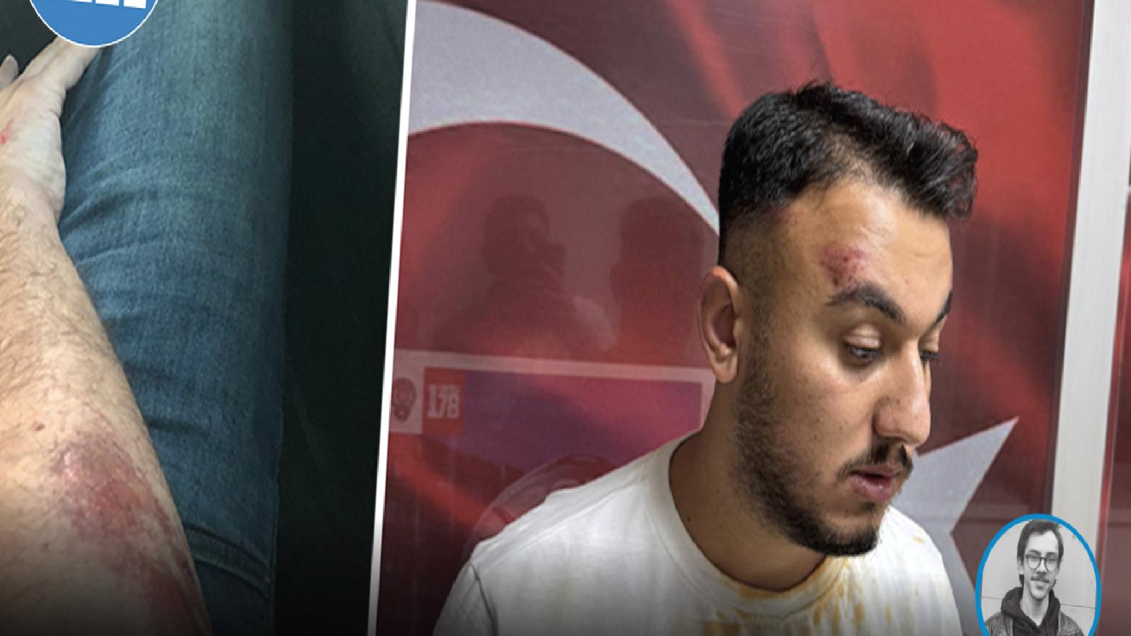 Pendik’te yoldan geçen kişilere “Huzur Denetimi” yapan polisten biber gazlı müdahale: Küfür ve darp iddiası!