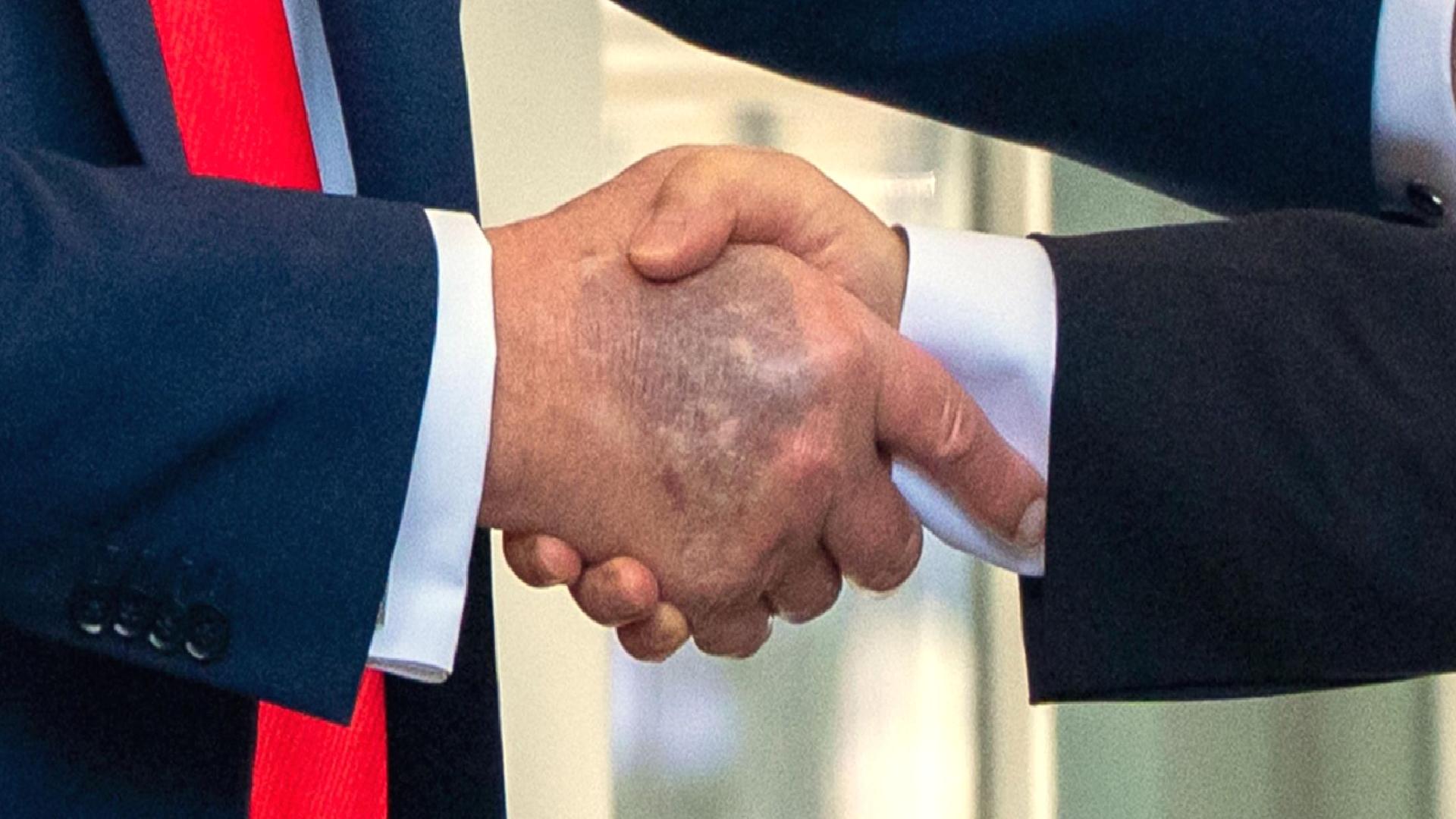 ‘Trump öldü’ haberi manşetlere taşındı, elindeki gizemli morluk ABD’yi karıştırdı: Canlı yayında gerçeği açıkladılar