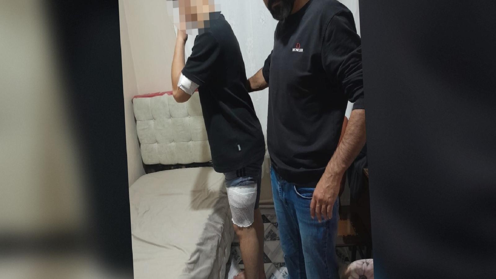 Akran zorbalığı: Okuldaki mendil kapma yarışında başlayan kavgada 16 yaşındaki çocuk, bıçaklandı!