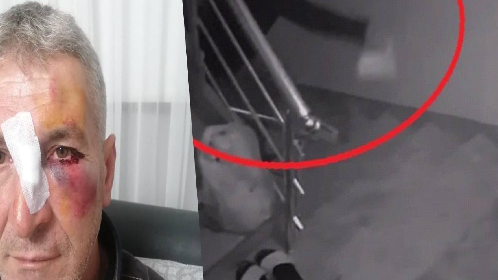 Dairesinin önüne hayvan dışkısı atan komşusundan, bu kez ‘yüzüne kapı çarptığı’ için şikayetçi oldu