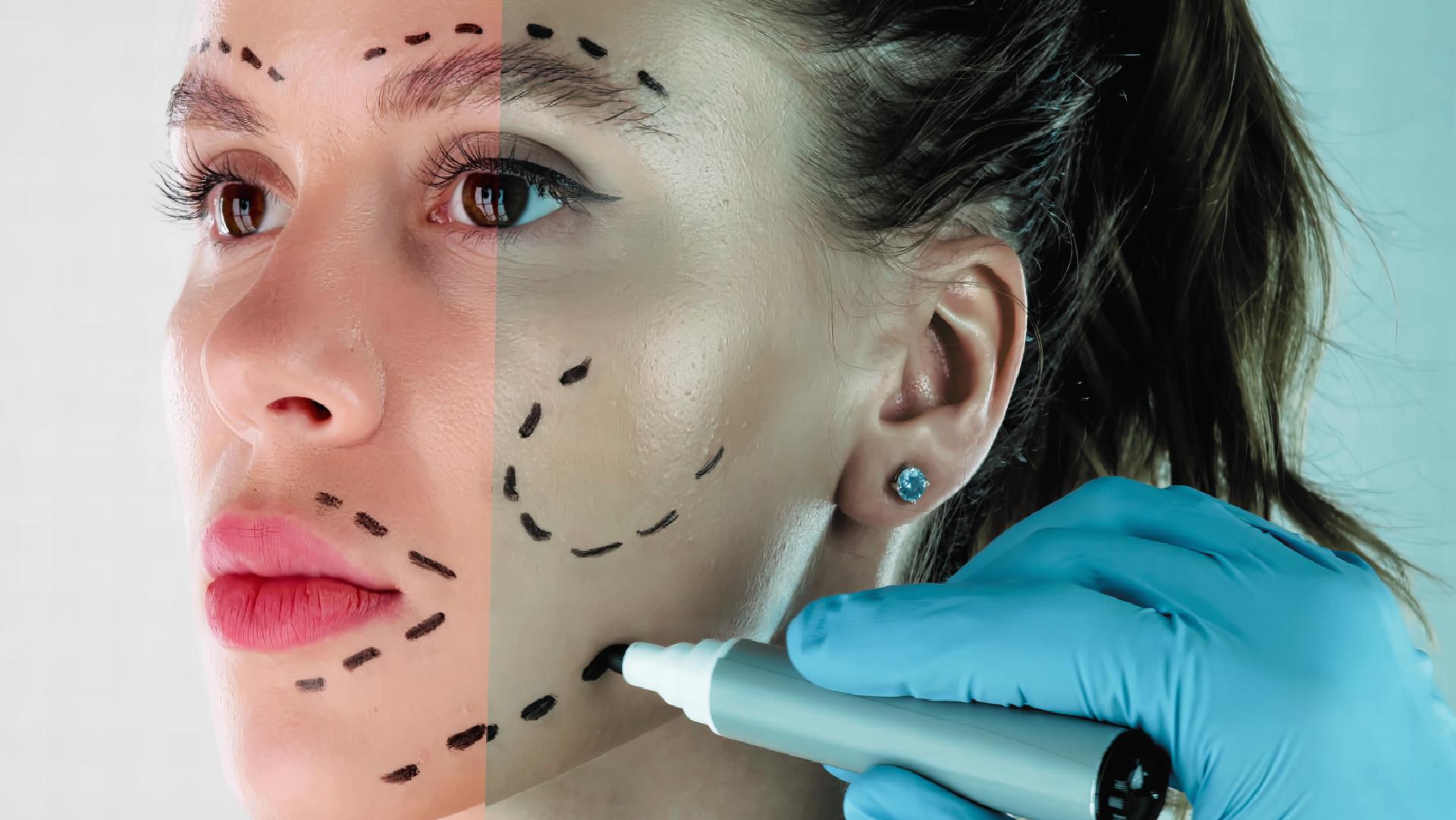 Almanya’da mahkeme, estetik ameliyatlarda ‘öncesi-sonrası’ fotoğrafların paylaşılmasını yasakladı