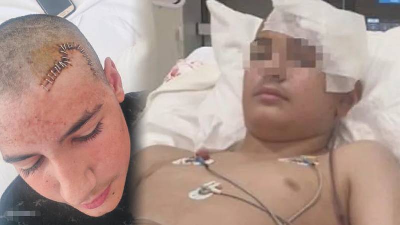 Konya’da akran şiddeti: 13 yaşındaki çocuğun kafatası taşla kırıldı, serbest bırakılan saldırgan “baba tahliye” paylaşımı yaptı!