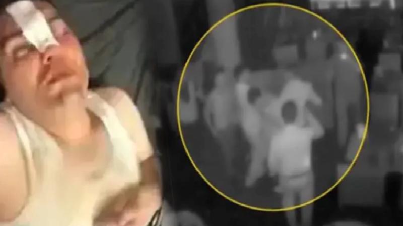 13 bin 500 liralık hesaba itiraz edince darbedildi: Çerezi arkadaşlarımla beraber, dayağı tek yedim!