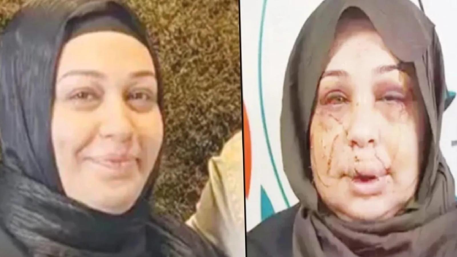 Boşanmak isteyen eşinin yüzünü kesen polis memuru Yasin Çakmak için 15 yıl hapis istemi