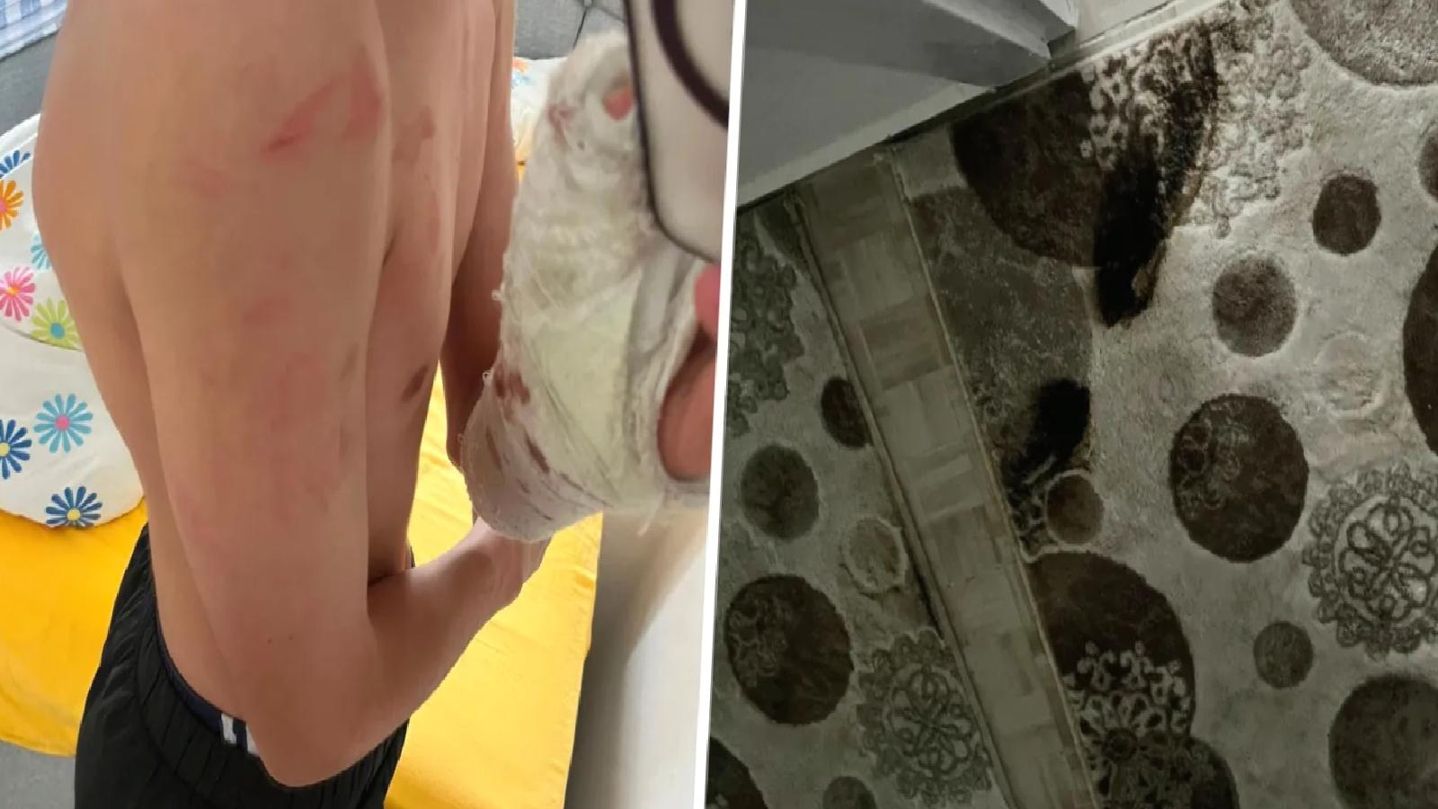 İddia: Polisler ‘yanlış adrese’ baskın yaptı; aile darbedildi, 15 yaşındaki çocuğun kolu kırıldı!